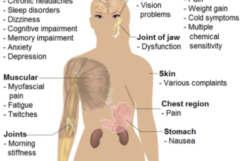 KAREN’S FRIDAY FAQs: What is Fibromyalgia?